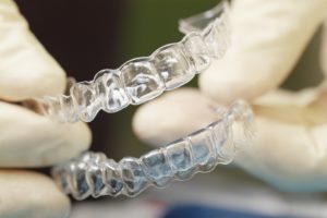 Invisalign braces - orthodontics